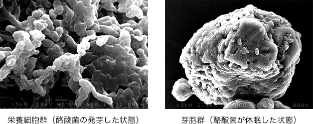 栄養細胞群（酪酸菌の発芽した状態）栄養細胞群（酪酸菌の発芽した状態）